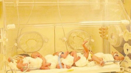 امرأة تنجب 5 توائم في اربيل